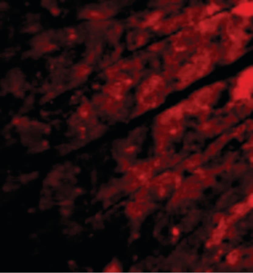 TRPC3 Antibody