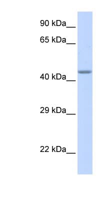 Polyclonal Rabbit anti-Human ZNF589 Antibody (aa216-265, WB)