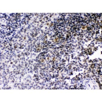 Polyclonal Rabbit anti-Human RAG2 / RAG-2 Antibody (aa498-527, IHC, WB)