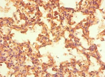 NR2C1 Antibody (aa1-240)