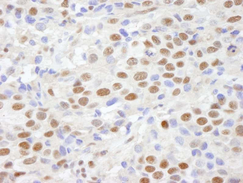 Polyclonal Rabbit anti-Human CHD8 Antibody (aa2252-2302, IHC)