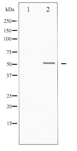 Vitamin D Receptor / VDR Antibody (phospho-Ser208)