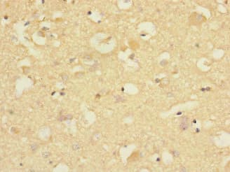 Polyclonal Rabbit anti-Human CNTNAP1 / CASPR / p190 Antibody (IHC, WB)