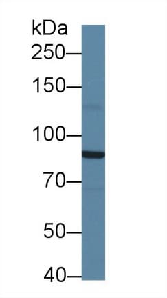 SIK2 / SNF1LK2 Antibody (aa674-916)