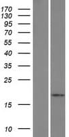 Human IL5 Protein (Over-Expression Lysate Myc-DDK (Flag))