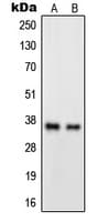 GPR82 Antibody (Internal)