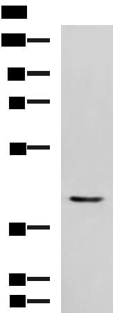 Polyclonal Rabbit anti-Human STK32A Antibody (IHC, WB)