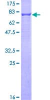 Human KRT6A / CK6A / Cytokeratin 6A Protein (Recombinant GST)