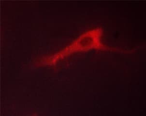 ADD1 / Adducin Alpha Antibody (phospho-Ser726)