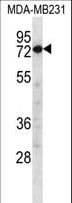 CAPN8 / Calpain 8 Antibody (aa290-318)