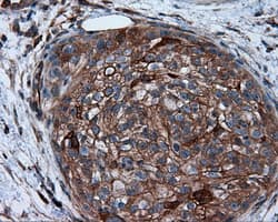 PIM2 / Pim-2 Antibody (clone OTI8G10)
