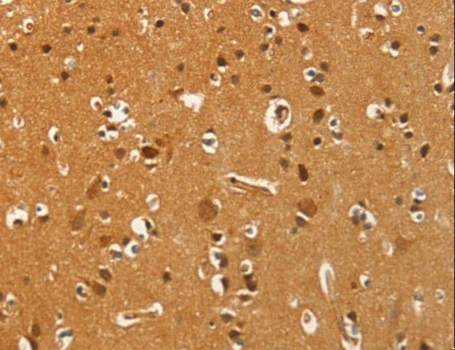 Polyclonal Rabbit anti-Human PFKFB1 Antibody (IHC)