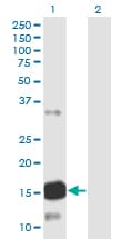 Monoclonal Mouse anti-Human ATXN7L1 Antibody (clone 1H2, WB)