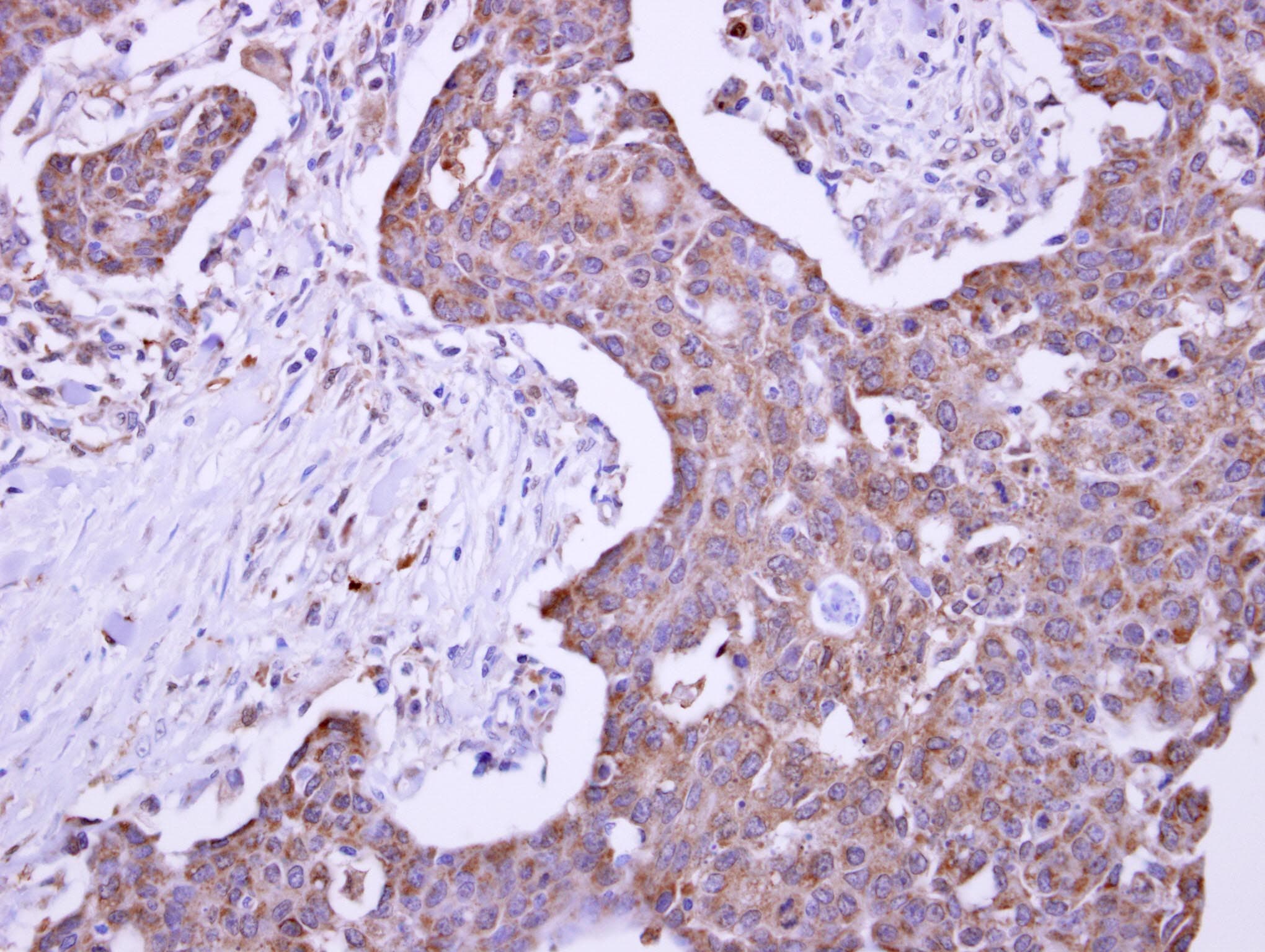 Polyclonal Rabbit anti-Human KIAA0152 / MLEC Antibody (aa106-292, IHC, WB)