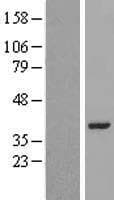 LRRC39 Protein (Over-Expression Lysate Myc-DDK (Flag))