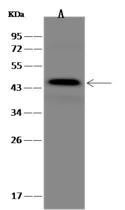 Polyclonal Rabbit anti-Human GAP43 Antibody (Preservative Free, IHC, WB)
