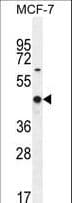 WT1 / Wilms Tumor 1 Antibody (aa346-375)