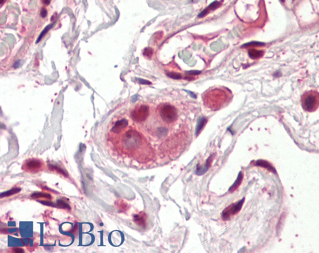 IHC-plus™ Polyclonal Goat anti-Human AES / Groucho Antibody (aa79-91, IHC, WB)