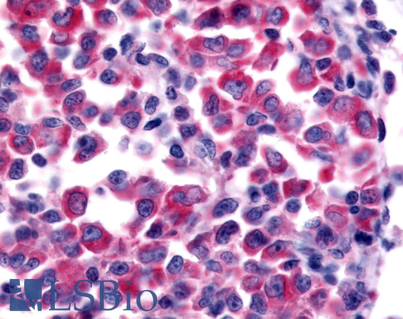 PathPlus™ Polyclonal Rabbit anti-Human NEK9 Antibody (Kinase Domain, IHC)