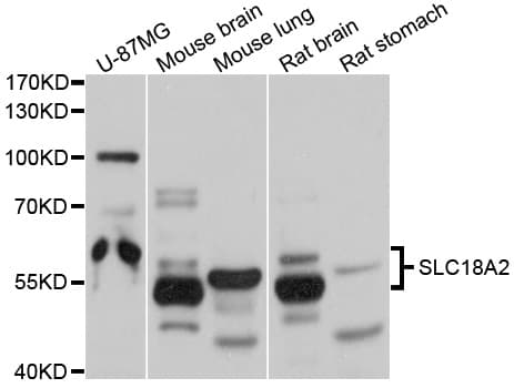 Polyclonal Rabbit anti-Human SLC18A2 / VMAT2 Antibody (IHC, WB)
