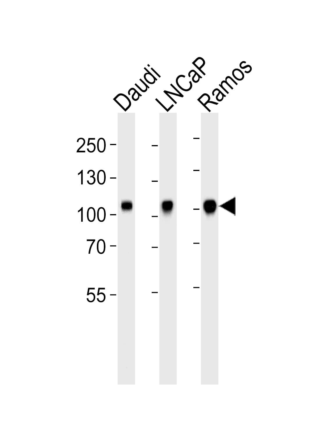 Polyclonal Rabbit anti-Human MME / CD10 Antibody (aa99-132, IHC, WB)
