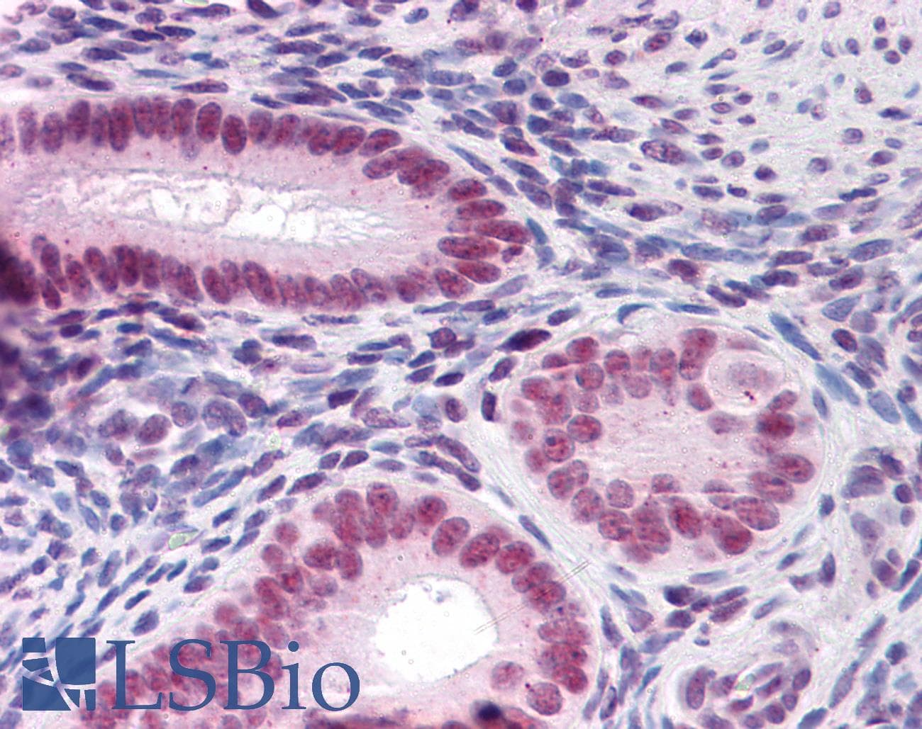 PathPlus™ Monoclonal Mouse anti-Human CBFA1 / RUNX2 Antibody (clone 1D2, IHC, IF, WB)