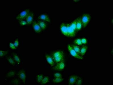 Polyclonal Rabbit anti-Human ID2 Antibody