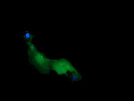 RAB21 Antibody (clone OTI6E12)