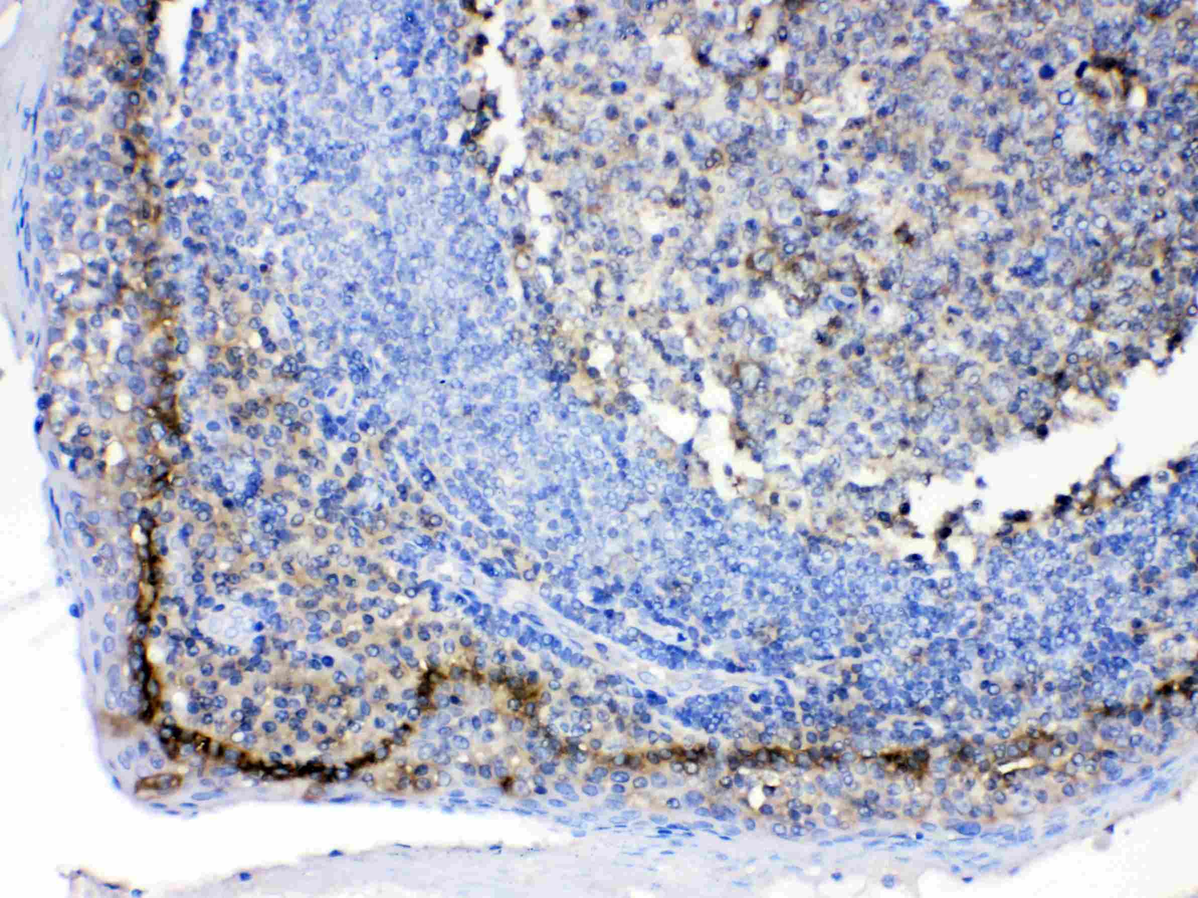 Basigin / Emmprin / CD147 Antibody