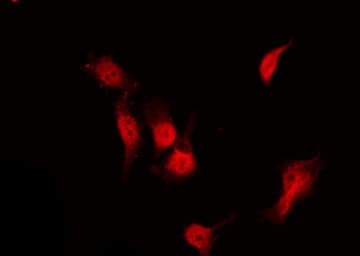 Polyclonal Rabbit anti-Human HDAC3 Antibody (phospho-Ser424, IHC, IF, WB)