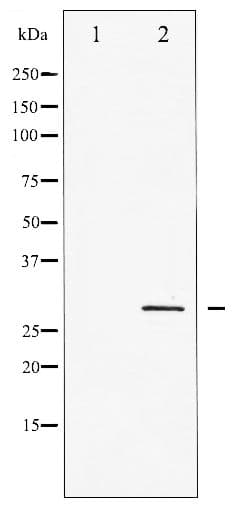Polyclonal Rabbit anti-Human CDKN1B / p27 Kip1 Antibody (phospho-Thr198, WB)