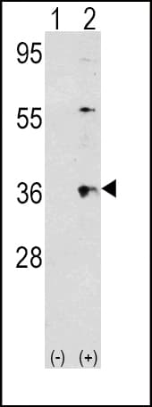 THPO / TPO / Thrombopoietin Antibody (aa243-273)