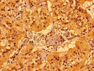 MCAT Antibody