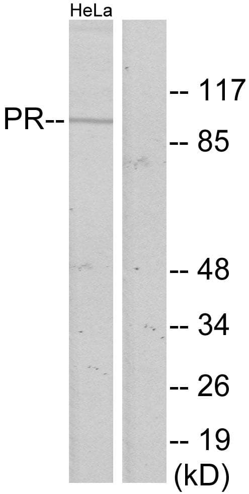 Polyclonal Rabbit anti-Human PR / Progesterone Receptor Antibody (p400, IHC, IF, WB)