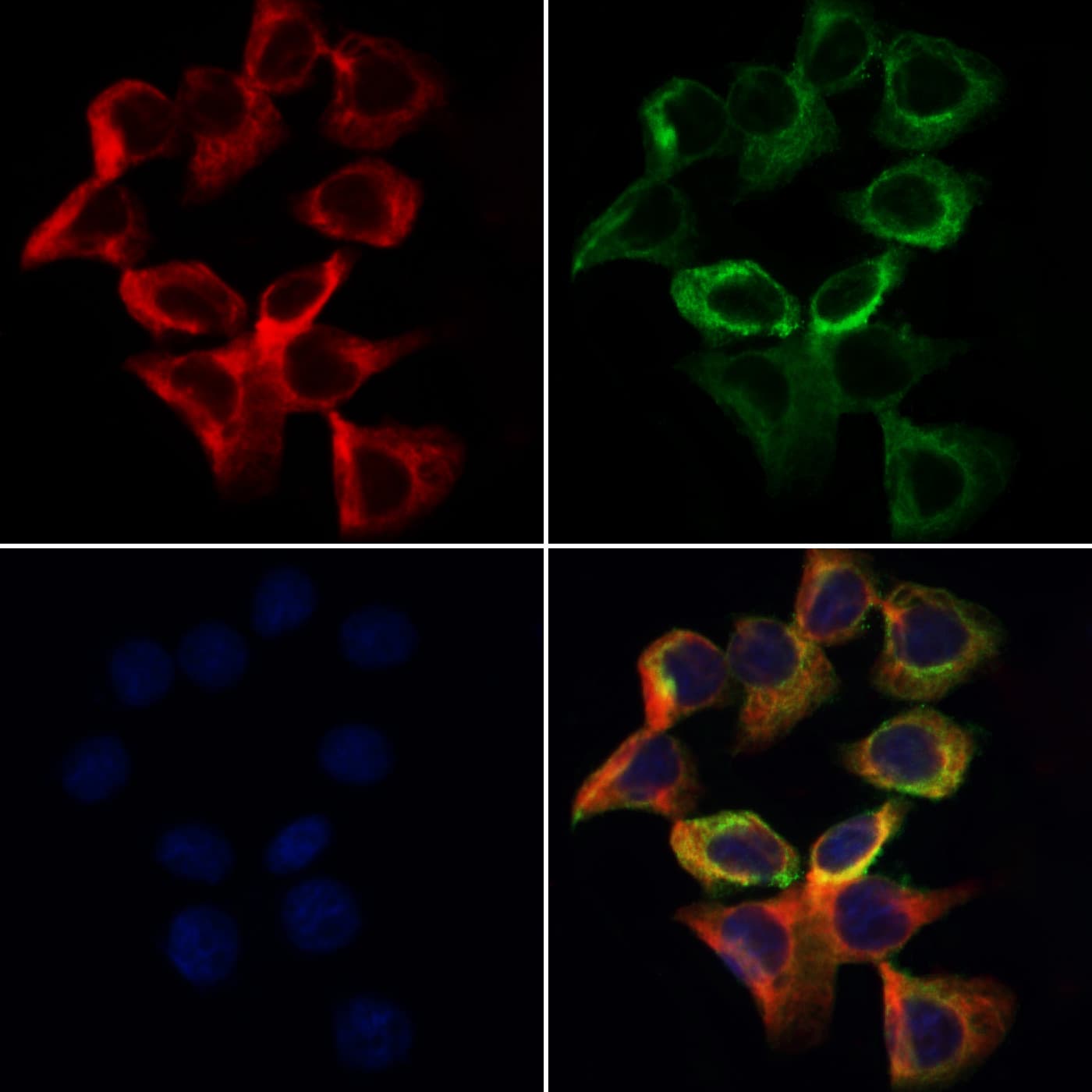 ALDH5A1 Antibody