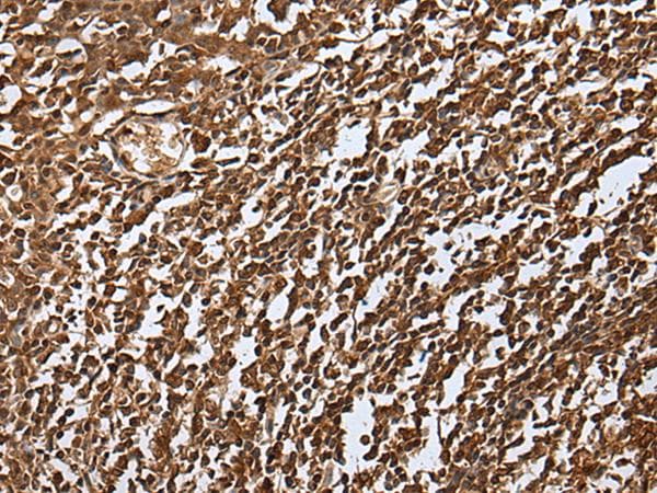 Polyclonal Rabbit anti-Human UEV1 / UEV1A Antibody (IHC, WB)