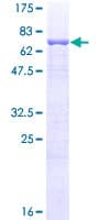 Human ESRRA / ERR Alpha Protein (Recombinant GST)
