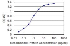 TBL1XR1 / TBLR1 Antibody (clone 3G7)