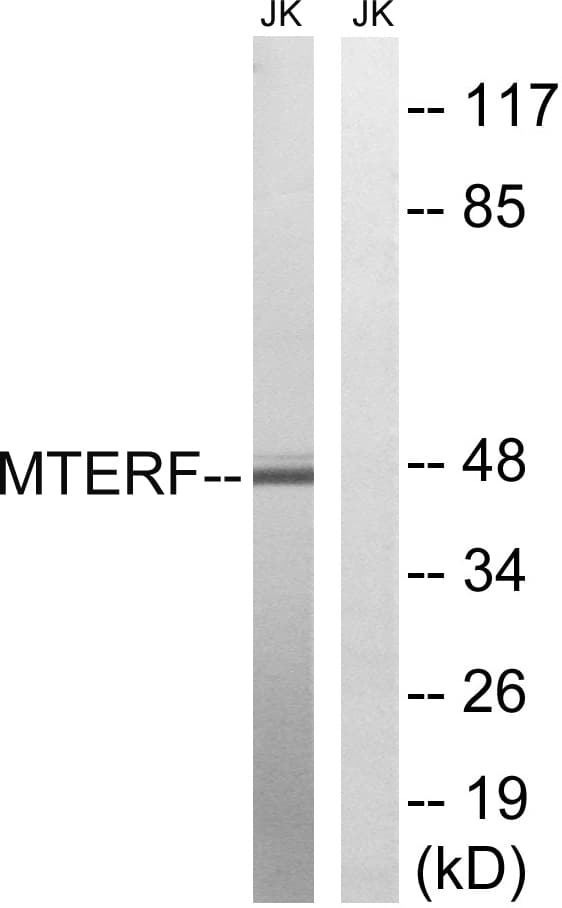 Polyclonal Rabbit anti-Human MTERF1 Antibody (aa267-316, IHC, WB)
