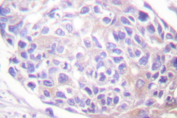 RPS6KA1 / RSK1 Antibody (Thr353)