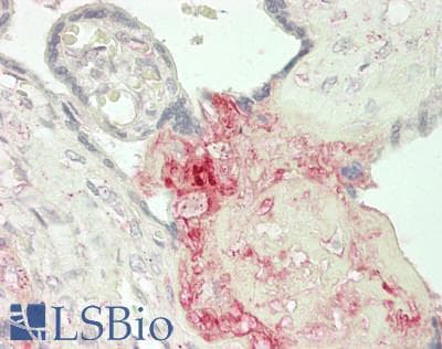 IHC-plus™ FN1 / Fibronectin Antibody (aa 627-688)