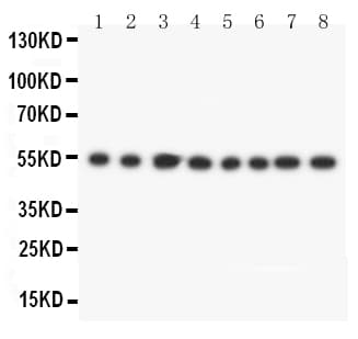 DLD / Diaphorase / E3 Antibody (aa492-509)
