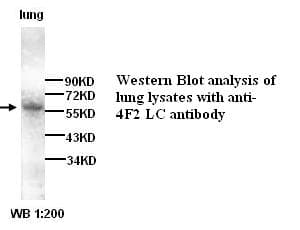 IHC-plus™ Polyclonal Rabbit anti-Human SLC7A5 / CD98 Light Chain Antibody (IHC, WB)