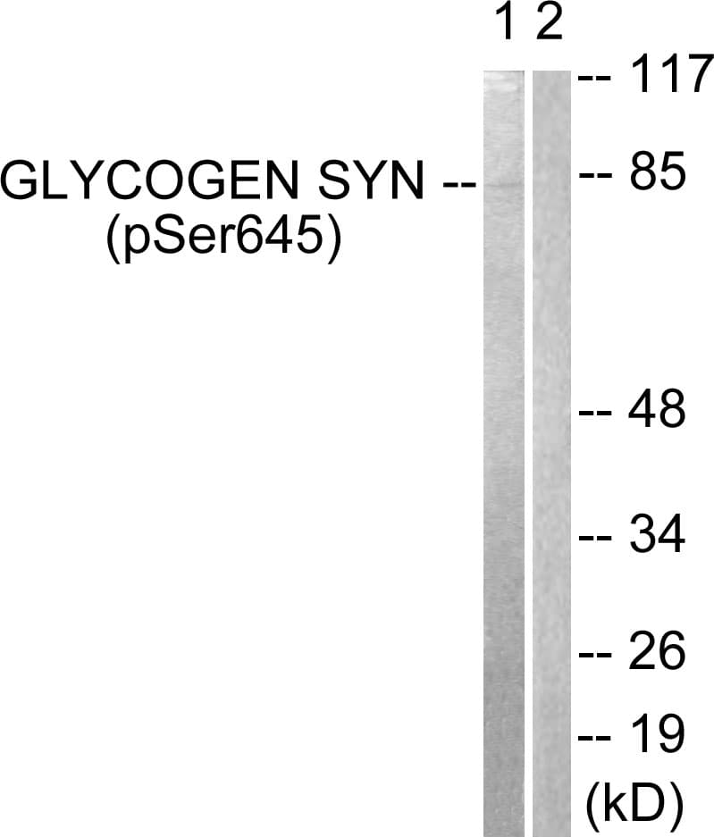 GYS1 / Glycogen Synthase Antibody (phospho-Ser645)