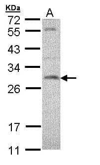 IHC-plus™ Polyclonal Rabbit anti-Human SNAP23 / SNAP-23 Antibody (IHC, WB)