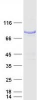 Human NUMB Protein (Recombinant Myc-DDK (Flag))