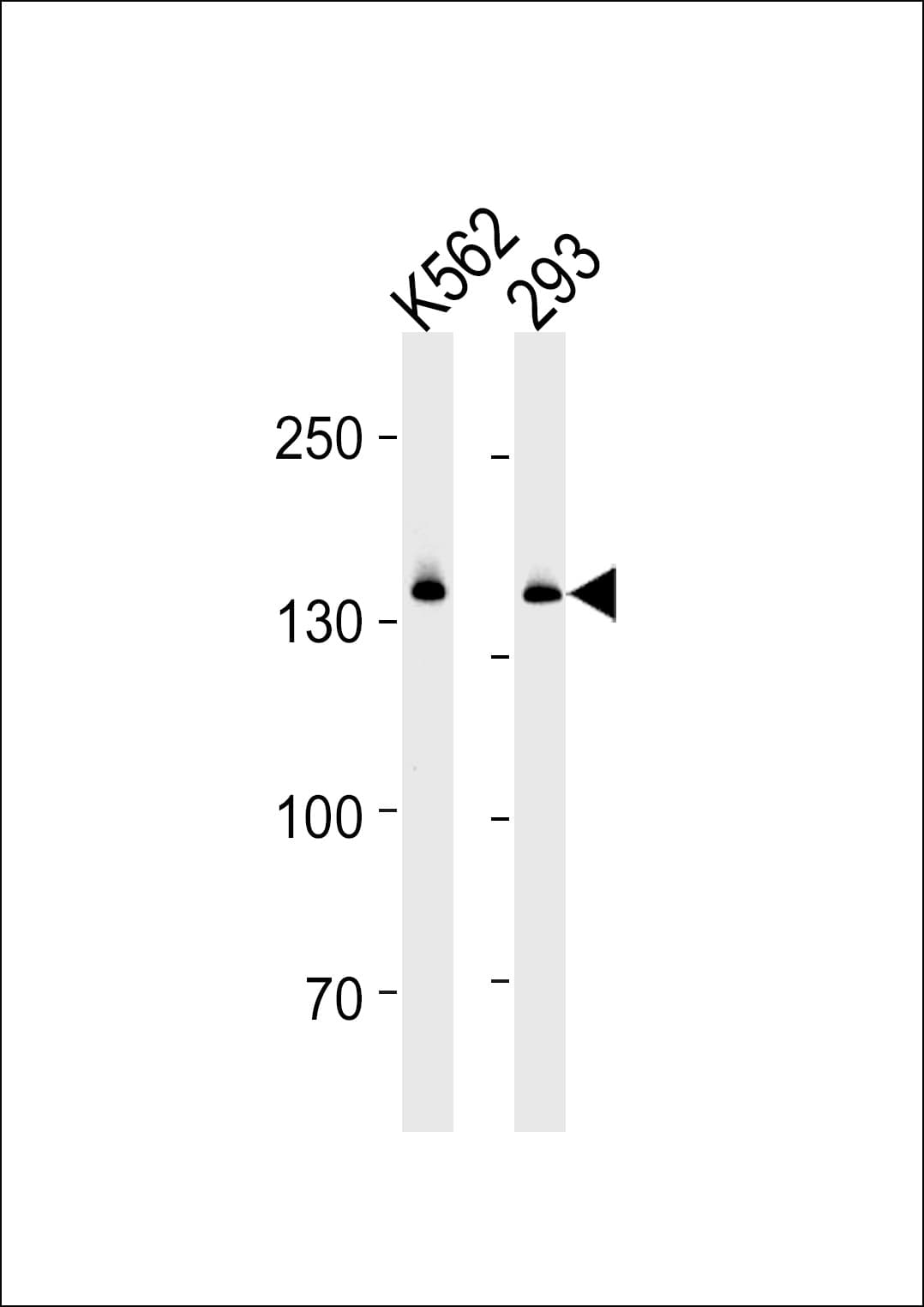DHX9 Antibody (aa1-30)