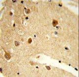 CNDP1 Antibody (aa415-443)