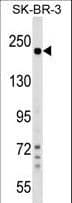 Polyclonal Rabbit anti-Human SHROOM2 Antibody (aa599-625, WB)