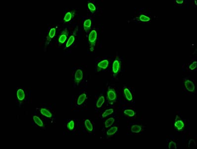 HIST1H1C Antibody